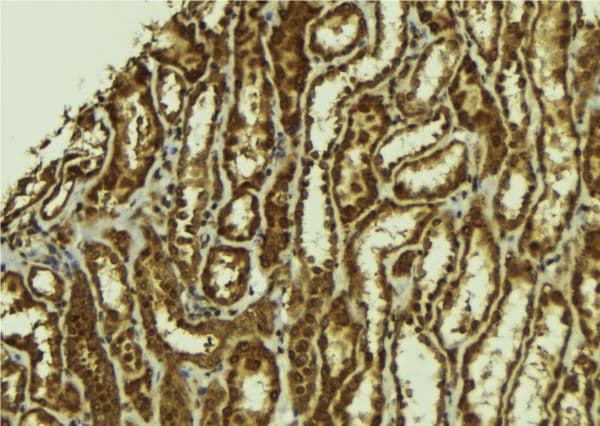 Polyclonal Rabbit anti-Human RAB3IP / RABIN3 Antibody (IHC, WB)
