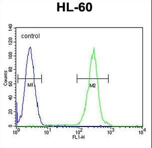 Polyclonal Rabbit anti-Human PRSS3 / Trypsin 3 Antibody (aa136-163, IHC, WB)