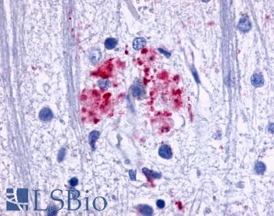 PathPlus™ Polyclonal Rabbit anti-Human ADGRE3 / EMR3 Antibody (N-Terminus, IHC)