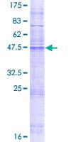 Human MMA / MMD Protein (Recombinant GST)
