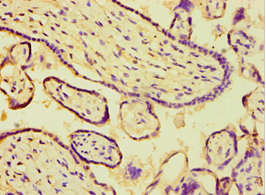 Polyclonal Rabbit anti-Human ARSF / Arylsulfatase F Antibody (aa1-200, IHC)