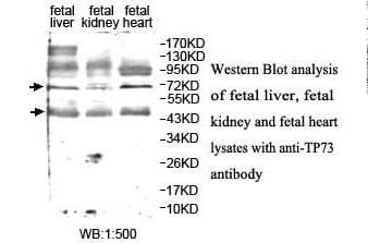 Polyclonal Rabbit anti-Human TP73 / p73 Antibody (aa420-633, IHC, WB)