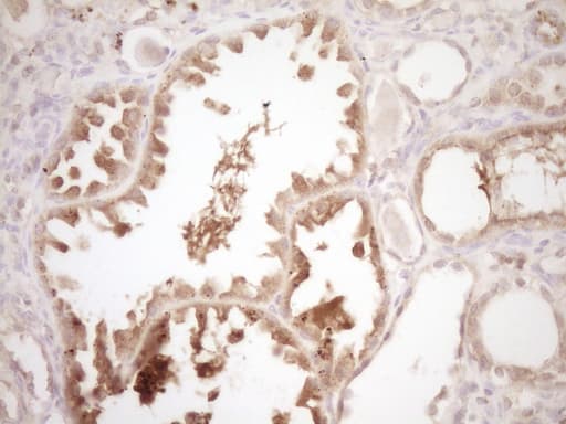 ERBB3 / HER3 Antibody (clone OTI3E10)