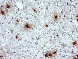 KLK8 / Kallikrein 8 Antibody (clone OTI5B1)