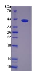 Rat Prothrombin Fragment 1+2 Protein (Recombinant His-T7)