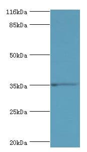 SULT1B1 / Sulfotransferase 1B1 Antibody (aa1-271)