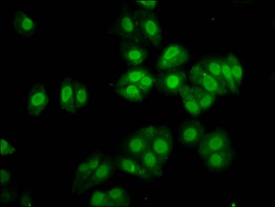 Polyclonal Rabbit anti-Human SOX30 Antibody (IHC, IF)