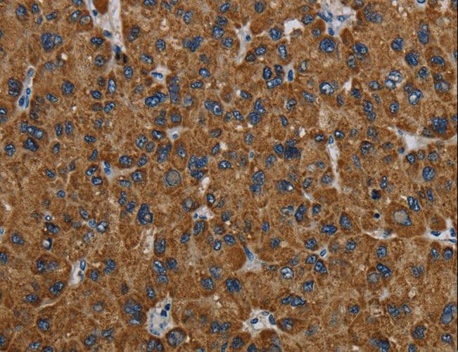 Polyclonal Rabbit anti-Human PCK2 / PEPCK Antibody (IHC, WB)
