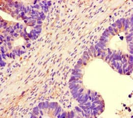 NBEAL2 Antibody