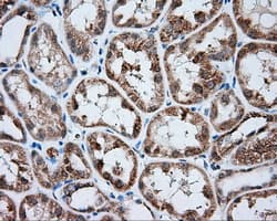 HMRF1L / MTRF1L Antibody (clone OTI2H8)