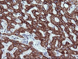 ZSCAN21 / Zipro1 Antibody (clone OTI2E5)