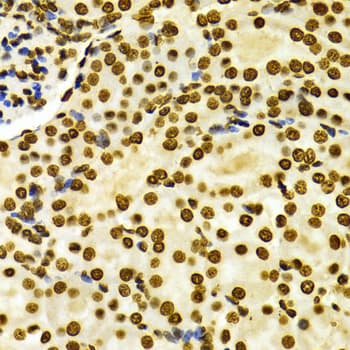 Histone H3 Antibody (Dimethyl-Lys27)
