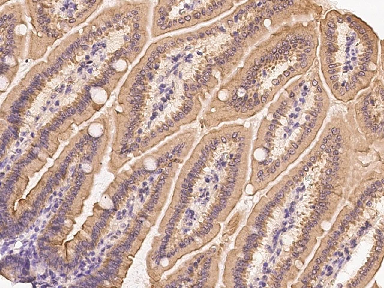 CIDEB Antibody