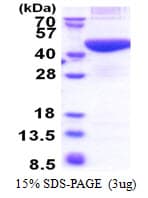 Human PRPSAP2 Protein (Recombinant His)