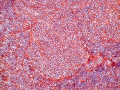 HLA-DR Antibody (clone EDU-1)