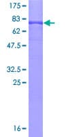 Human IP6K2 Protein (Recombinant GST)