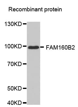 FAM160B2 / RAI16 Antibody