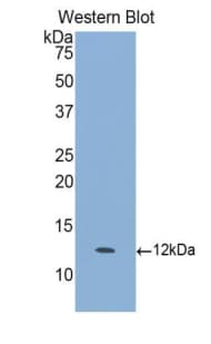 CXCL6 Antibody (aa40-114)