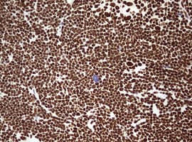 Monoclonal Mouse anti-Human HNRPM / HNRNPM Antibody (clone OTI3F3, aa1-261, IHC, WB)
