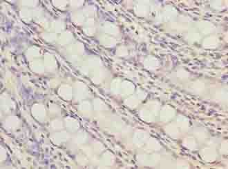 ZNF767 Antibody