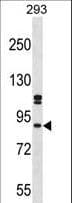 SUPT6H / SPT6 Antibody (aa99-127)