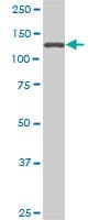SF3B2 Antibody (clone 5D2)