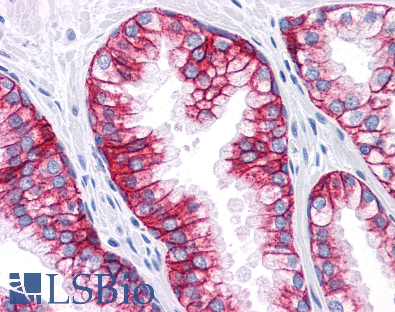 IHC-plus™ Monoclonal Mouse anti-Human EPCAM Antibody (clone VU-1D9, IHC, WB)