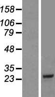 COQ10B Protein (Over-Expression Lysate Myc-DDK (Flag))
