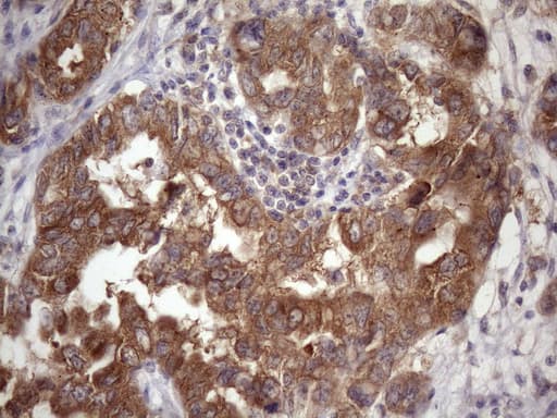 Monoclonal Mouse anti-Human Vps60 / CHMP5 Antibody (clone OTI5C7, Carrier-free, IHC, WB)