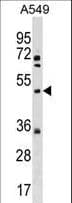 Polyclonal Rabbit anti-Human KX / XK Antibody (aa83-111, WB)