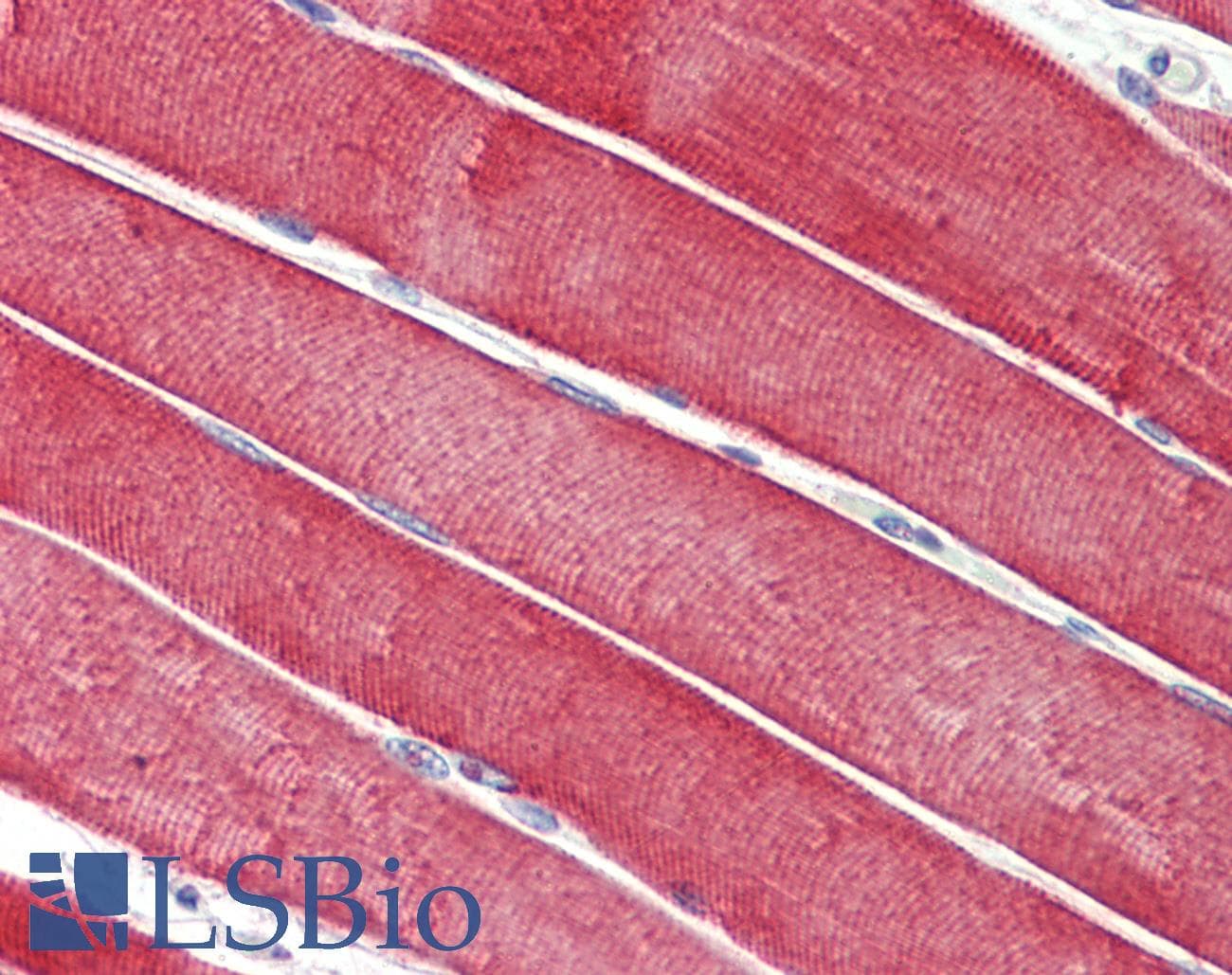 IHC-plus™ DNAJC5 / CSP Antibody (aa177-191)