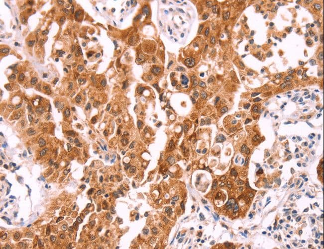 Polyclonal Rabbit anti-Human NCEH1 / AADACL1 Antibody (IHC, WB)