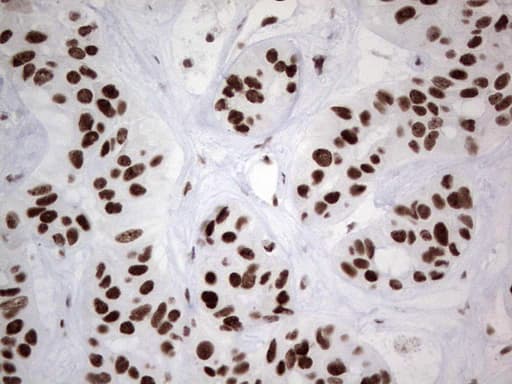 HDAC9 Antibody (aa181-460, clone OTI7G2, Carrier-free)