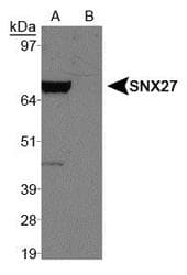 SNX27 Antibody (aa150-200, DY650)