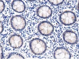 Monoclonal Mouse anti-Human DNAJA2 Antibody (clone OTI2A2, IHC, IF, WB)