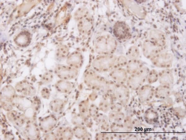 Monoclonal Mouse anti-Human GSC / Goosecoid Antibody (clone 3G6, IHC)