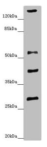 Polyclonal Rabbit anti-Human ZNF187 Antibody (IHC, WB)