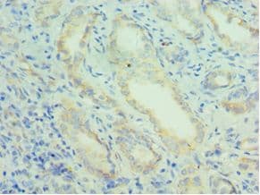 PRDX5 / Peroxiredoxin 5 Antibody (aa53-214)