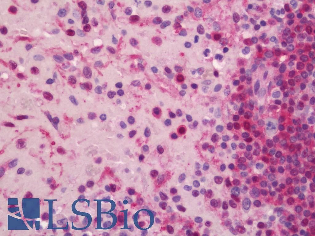 IHC-plus™ CHD1 Antibody (clone 1G2)