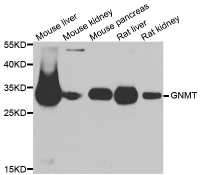 Polyclonal Rabbit anti-Human GNMT Antibody (IHC, WB)