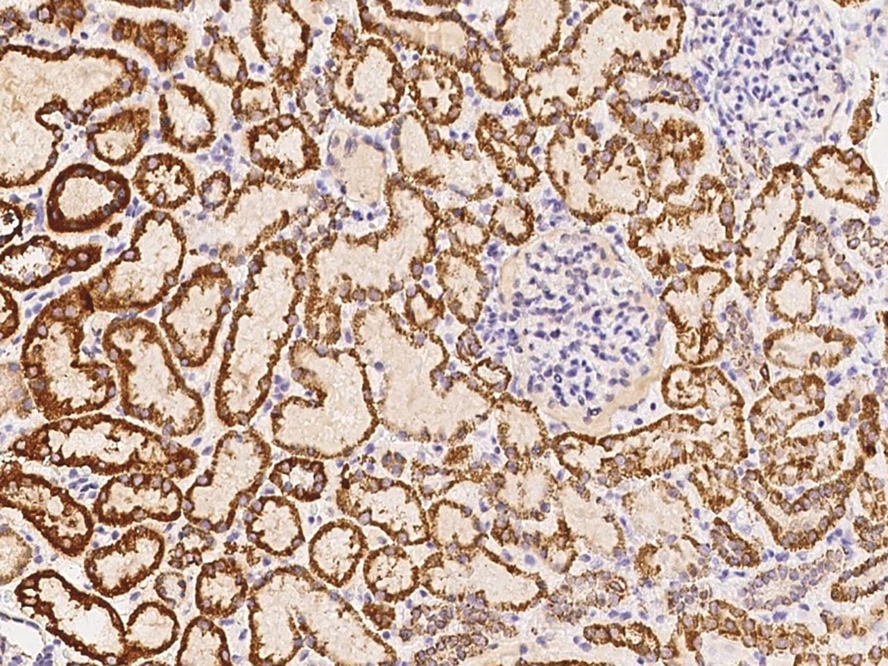 DECR1 Antibody (Preservative Free)