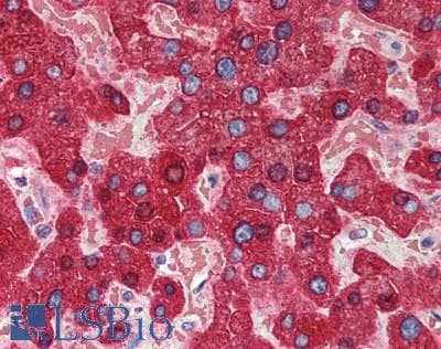 IHC-plus™ CYB5A / Cytochrome b5 Antibody