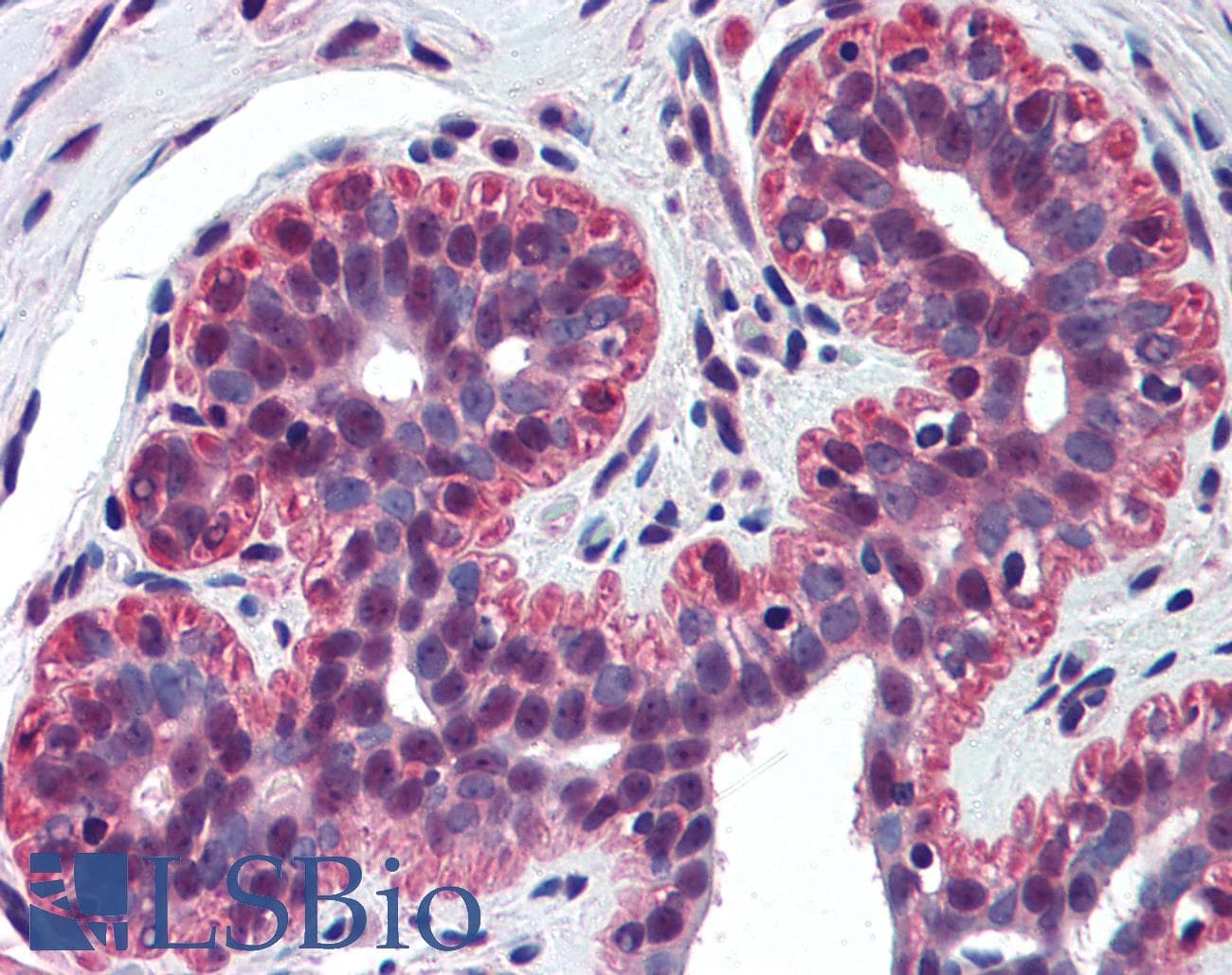 IHC-plus™ TP73 / p73 Antibody (N-Terminus, clone 5B429)