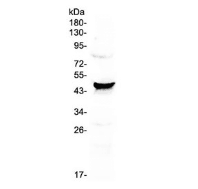 CCN3 / NOV Antibody