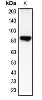 Polyclonal Rabbit anti-Human CHML Antibody (Internal, IHC, WB)