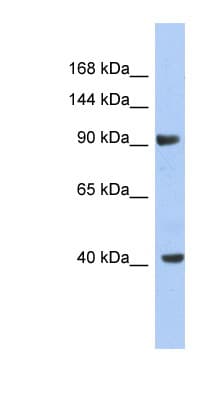 Polyclonal Rabbit anti-Human KCNH6 / Kv11.2 / ERG2 Antibody (C-Terminus, WB)