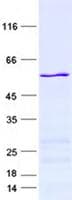 Human FBXL6 Protein (Recombinant His, N-Terminal)