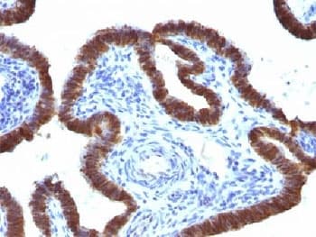 ASRGL1 Antibody (clone CRASH/1289)