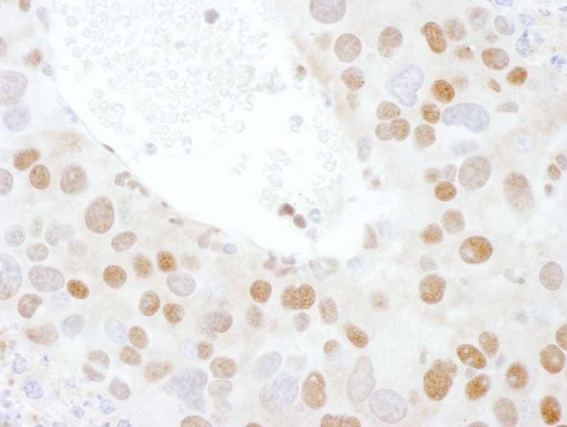 TDP-43 / TARDBP Antibody (aa250-300)