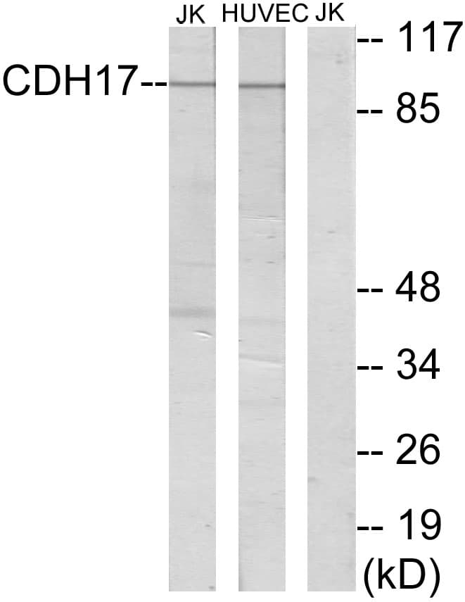 CDH17 / Cadherin 17 Antibody (aa341-390)
